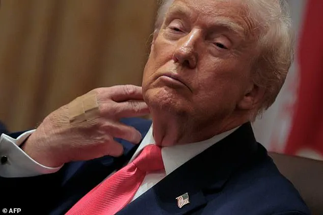 Presidential Health Speculation Resurfaces as Trump Denies Aging Signs