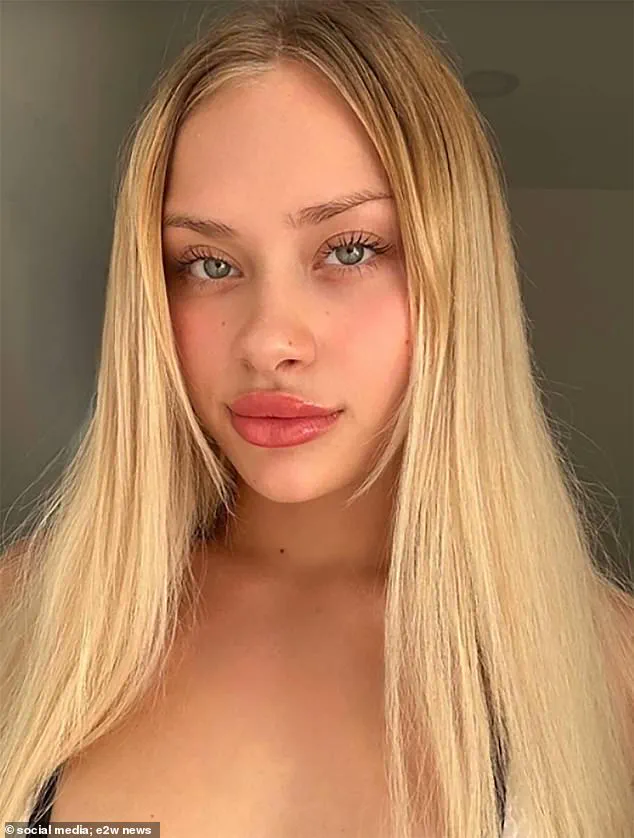 Ukrainian Woman's Remarkable Recovery After Severe Injury in Dubai