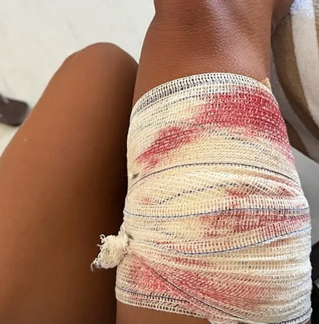 Shark Encounter Sparks Debate on Regulations Governing Human-Marine Life Interaction in Brazil's UNESCO Site