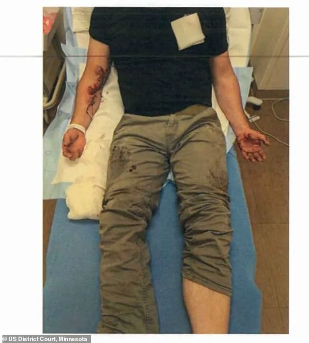 ICE Agent Jonathan Ross Suffers Internal Bleeding During Fatal Shooting of Renee Nicole Good on January 7 in Minneapolis, Michigan