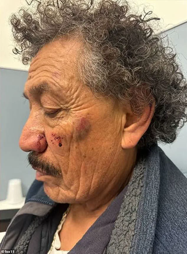 Lawsuit Against McDonald's Sparks Debate Over Workplace Safety Regulations and Corporate Accountability