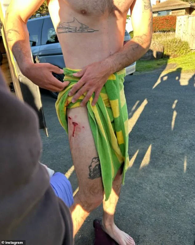 California Surfer Injured in Shark Attack Off Gualala Coast, Raises Questions About Human-Wildlife Coexistence