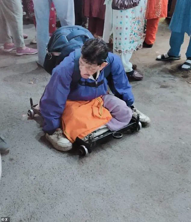 Indore's Sarafa Bazaar: The Unshakable Presence of Mangilal, a Leprosy-Sufferer in Daily Commerce