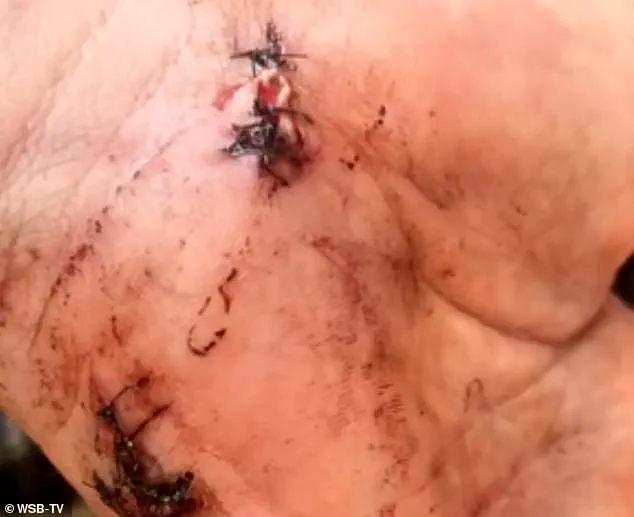 Georgia Groom Faces Murder Charges After Wedding Day Shooting, Sparking Legal and Ethical Controversy