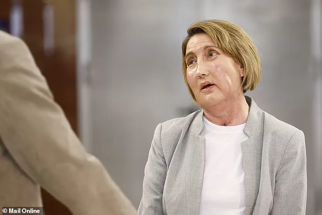 Barcelona Hospital Achieves World's First Facial Transplant from Assisted Dying Donor