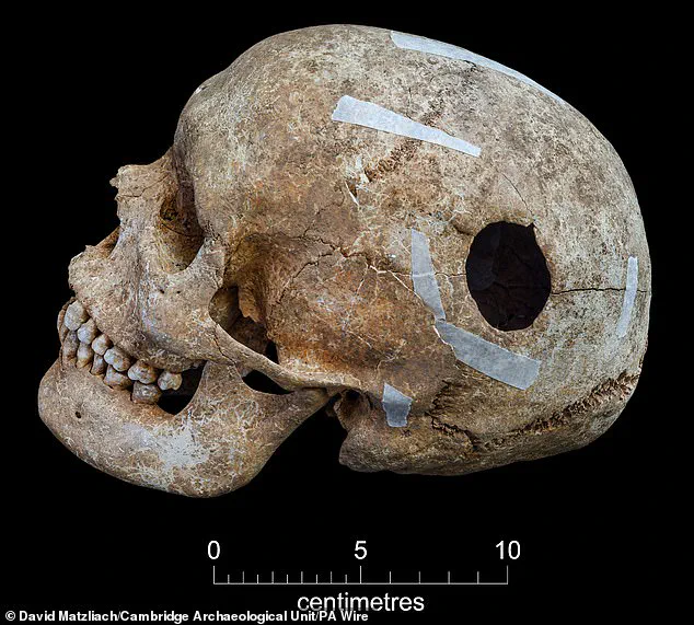 Harrowing Discovery of Viking-Era Mass Grave with Ritualistic Violence Unearths Ninth-Century Mystery in Cambridge