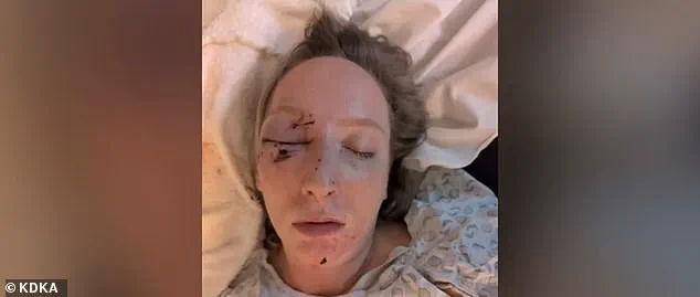 Massive Ice Slab Shatters Windshield on Parkway West, Injuring Driver and Shocking Child