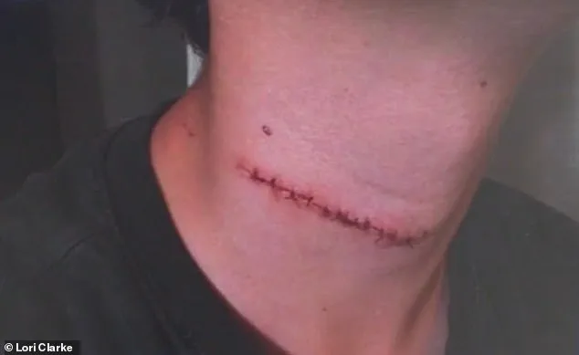 Teenager Slashed in Random Attack on Daytona Beach Boardwalk, Family Speaks Out