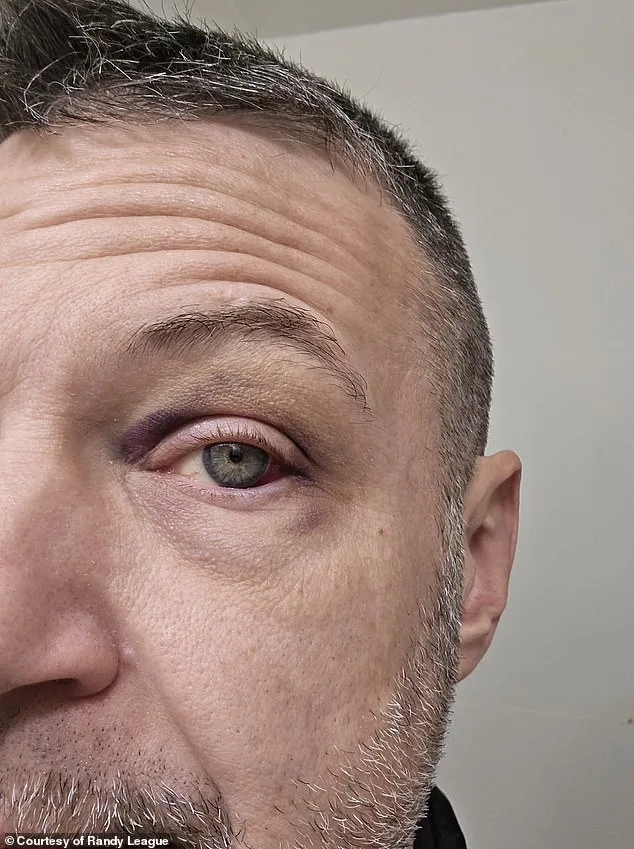 Rare Cancer Uncovered: Man's Eyes Give Away Fatal Disease.