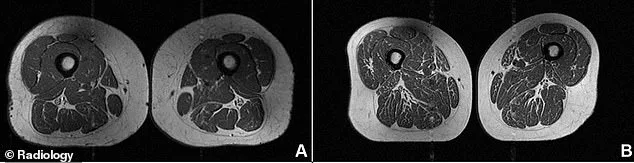 The Dark Side of Ultra-Processed Foods: Chilling Images Reveal Their Impact.