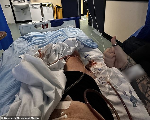 Man loses five stone on Mounjaro before life-threatening gallbladder infection strikes