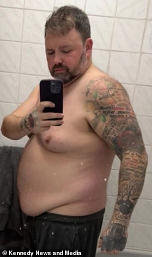 Man loses five stone on Mounjaro before life-threatening gallbladder infection strikes