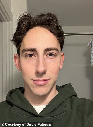 Celebrities Turn to Microdose Accutane for Anti-Aging Benefits