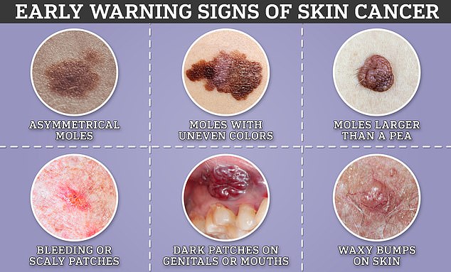 Global skin cancer cases expected to surge by 2050.
