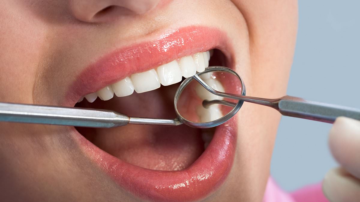 Bleeding Gums May Signal Severe Kidney Disease, Study Finds
