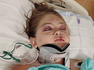 Idaho Mother Loses Legs After Boating Accident While Tubing With Children